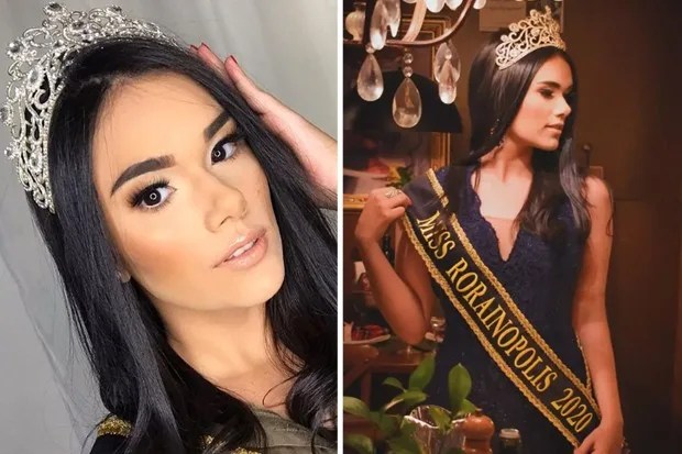 Miss em Roraima passa mal e morre aos 21 anos durante cirurgia de emergência
