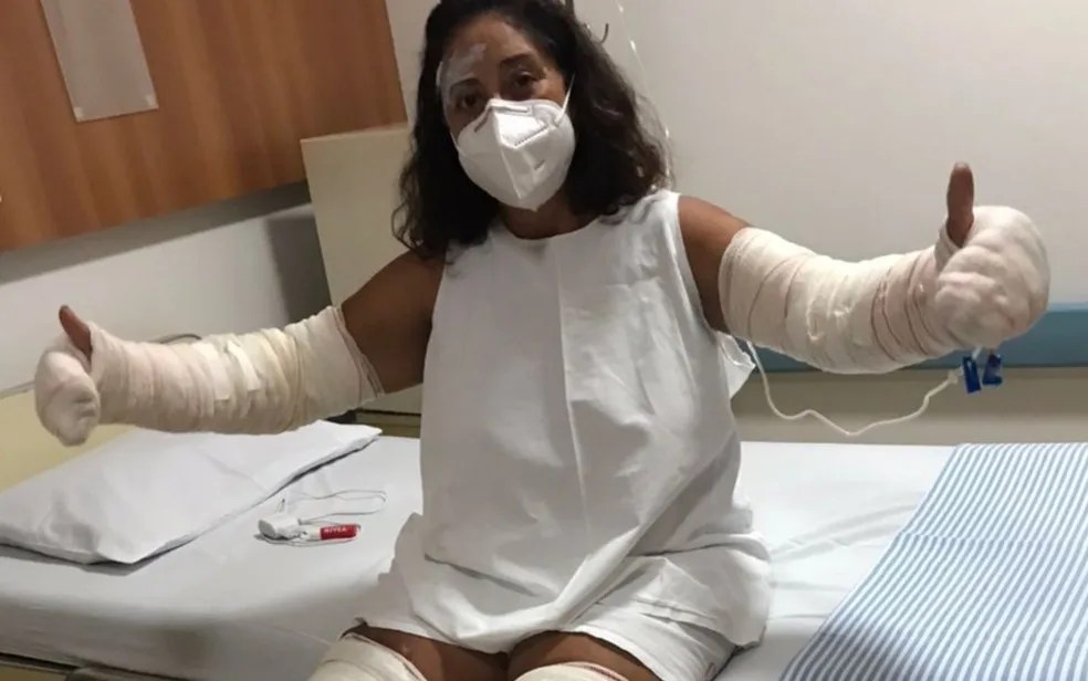 Frasco de desodorante explode e deixa professora com queimaduras