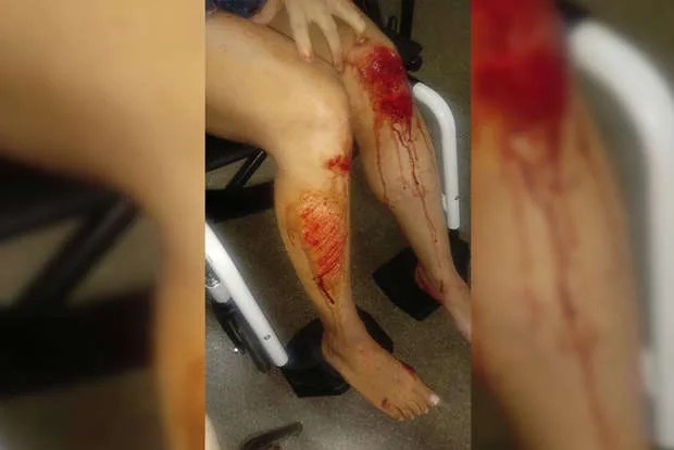 Ex-marido chega de surpresa em clube e espanca mulher