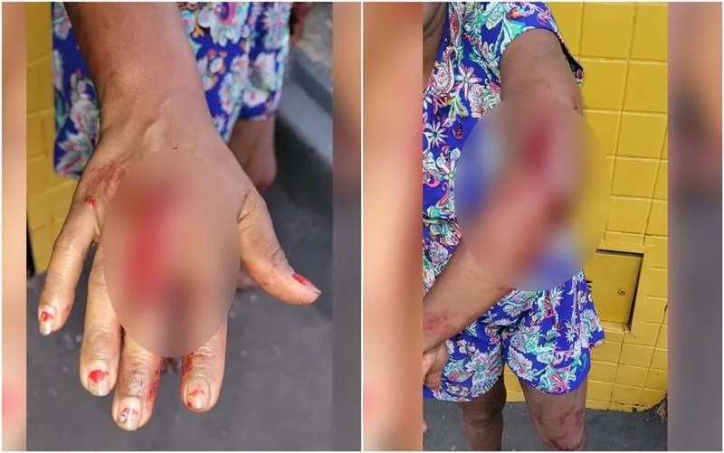 Briga por chinelo termina com uma mulher esfaqueada