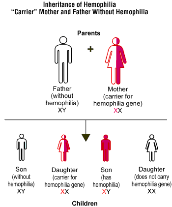 Color blindness can also result from . Hemophilia