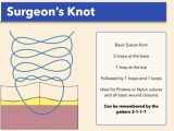 Wound Closure Techniques