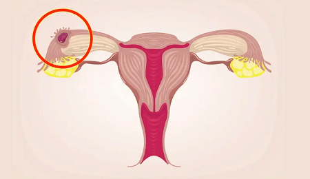 Is Abortion Ever Medically Justifiable?