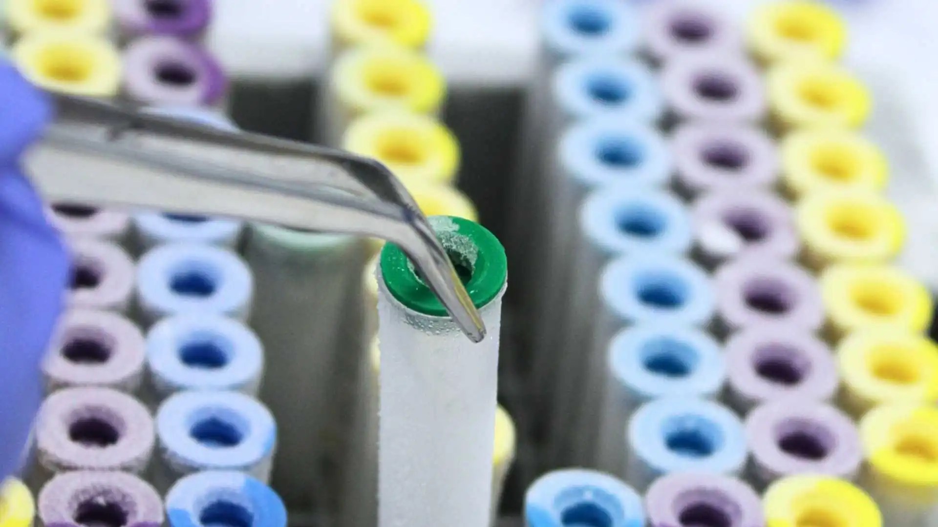 The role of biobanking