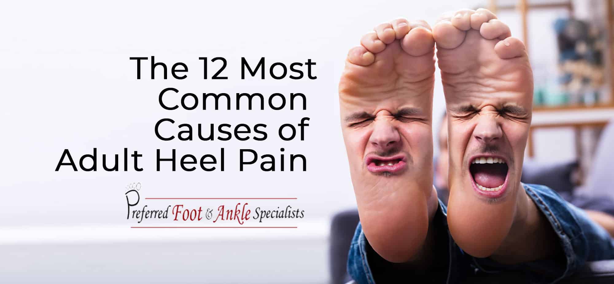 Common causes of heel pain in adults
