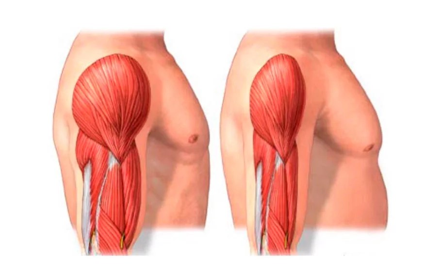 FOTO-2-MARTA-OK-SARCOPENIA-909x563