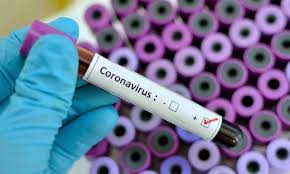 Nasarawa NMA Chairman,Bulus Tests positive to COVID19