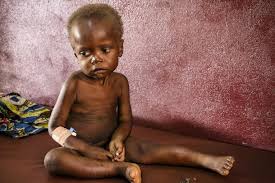 UNICEF Partners Delta Govt To Tackle Malnutrition