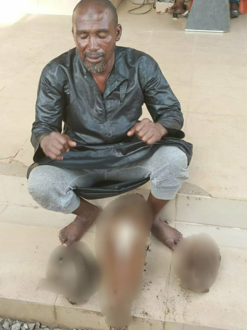Police Arrest Suspected Ritualists Who Trades In Human Parts