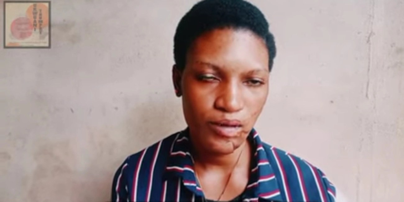 Lady Claims Her Mother Chopped Off Her Hands, Slashed Her Face With Machete