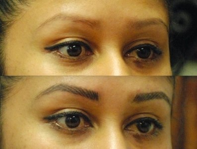 Tattoo lightening vs. tattoo removal