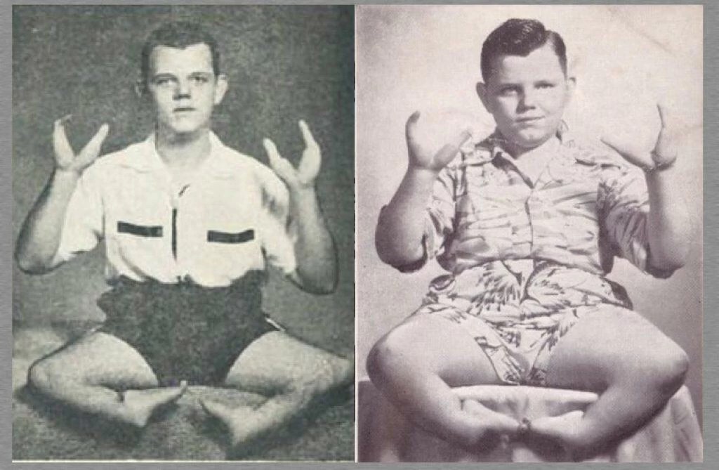 Grady Stiles: Jezivi zločin “Dječaka – jastoga”