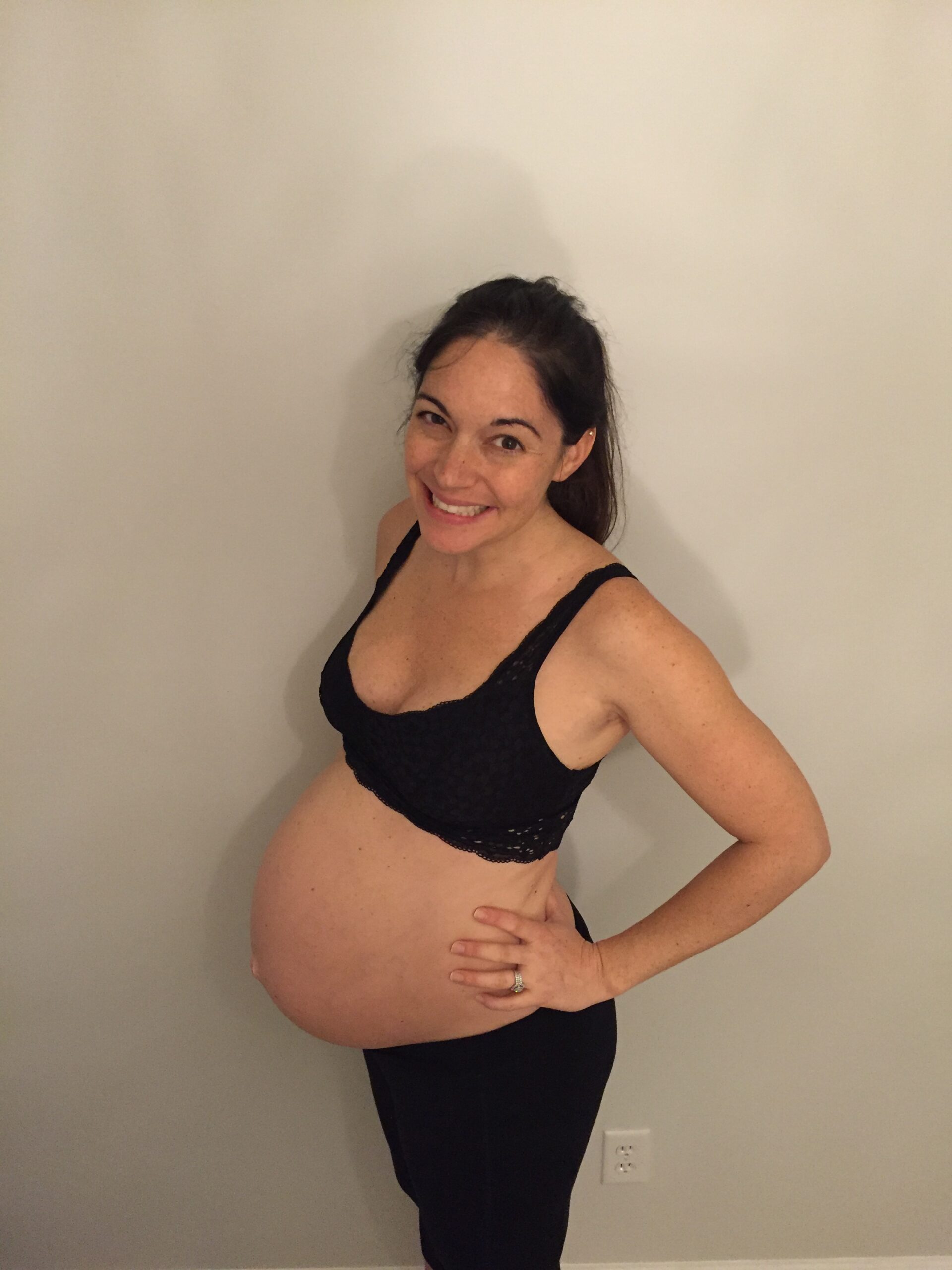 38 week Beauty Marks