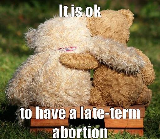 late term abortion