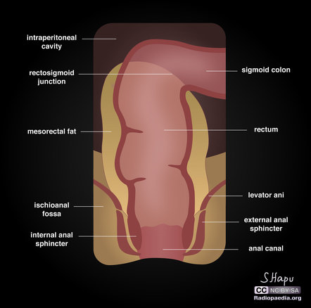 Gross anatomy toggle arrow icon. Rectum Radiology Reference Article Radiopaedia Org