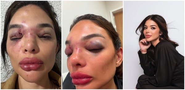 Latino nega acusações de agressão feitas pela ex-noiva: “Não tenho histórico”