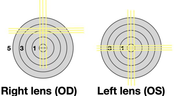 China New Optical Auto Lens Meter Digital Lensometer Cot L900 With Blue Light Test Buy Auto Lensometer With Blue Light Test Optical Auto Lens Meter Digital Lensometer Product On Alibaba Please mark the exact position where the wearer of the glasses looks through the lenses.