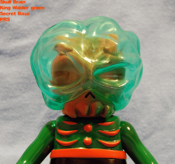 walderbrain03.png?ssl=1