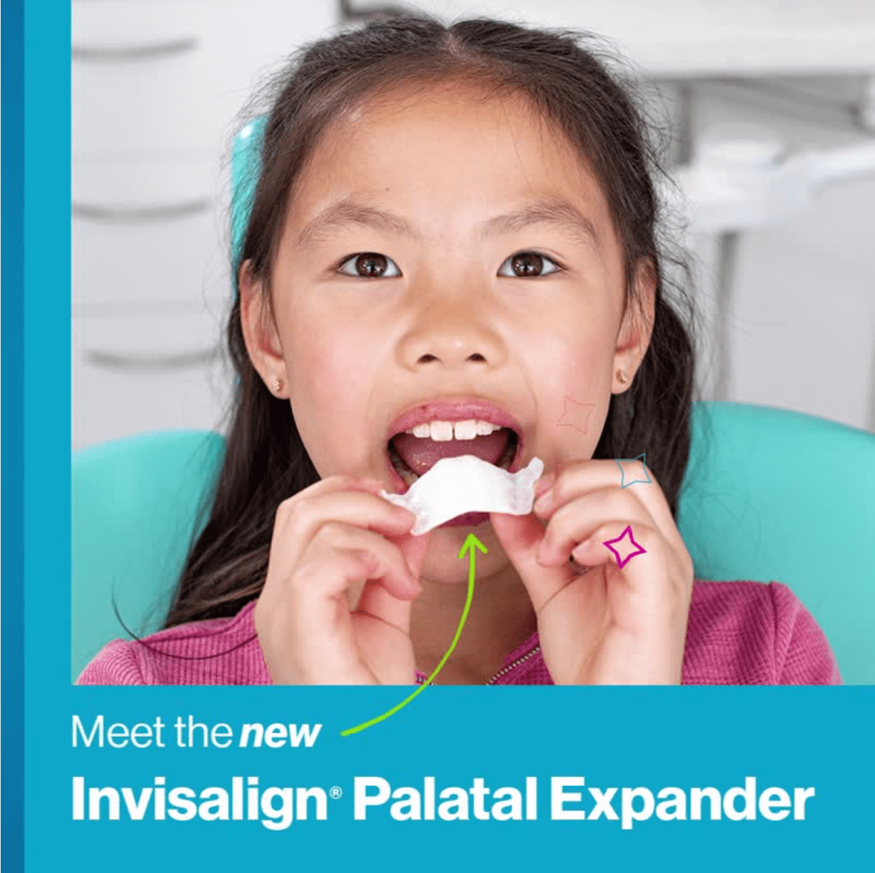 Invisalign Palatal Expander