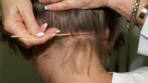 Atunci când copilul tău se scarpină adesea pe cap și știi că nu are . Èi Se Face Pielea De GÄinÄ O BÄtranÄ IÈi AminteÈte De Lupta Cu PÄduchii Provincialprovincial