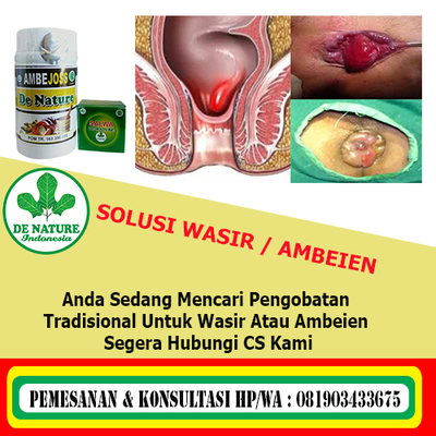 Bab berdarah menetes bisa terjadi karena berbagai sebab, termasuk masalah pada saluran pencernaan. Penyebab Buang Air Besar Berdarah Dan Solusinya Mudah