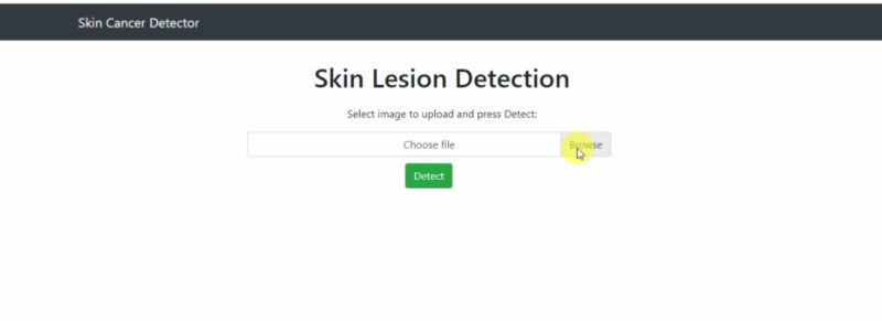 Github Codebymaaz Skin Cancer Detection Using Android The Smart Skin - Premium HD Vintage Designs | Free Download
