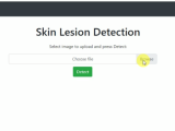 Skin Cancer Detection Using Flask Api A Smartphone Based Application