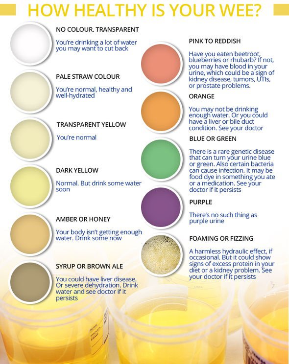  urine color chart