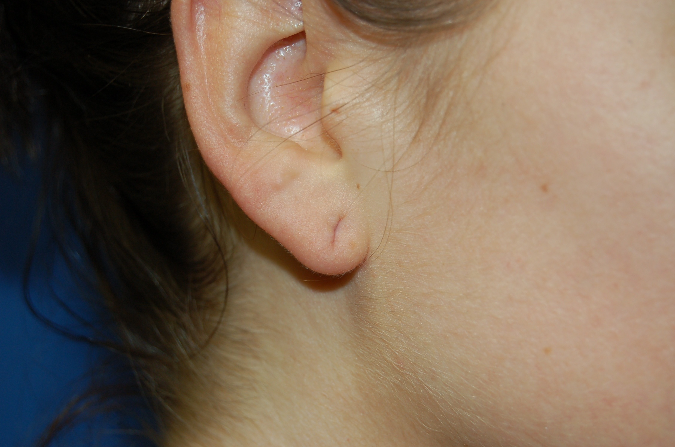 How long does it take for an ear piercing to close, and what should. If You Stretch An Earlobe Piercing Up To 1 2 Or Bigger Will It Shrink Down Again When You Take The Jewelry Out Quora