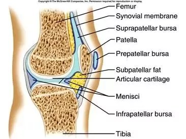 Apa penyebab nyeri sendi pada tubuh manusia? - Quora
