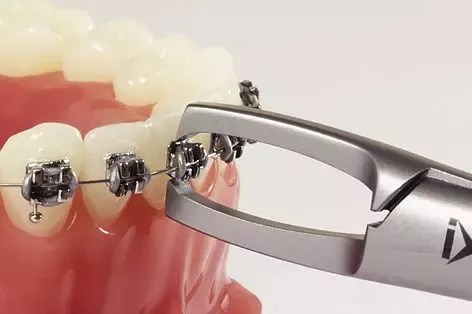 wallpapers How To Take Off A Bracket Braces quora