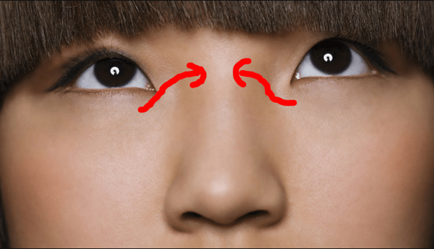 Adakah tips mengenai hidung tersumbat sebelah? - Quora