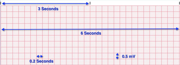 why does a faster ecg paper speed make the complexes wider and more spread out instead of