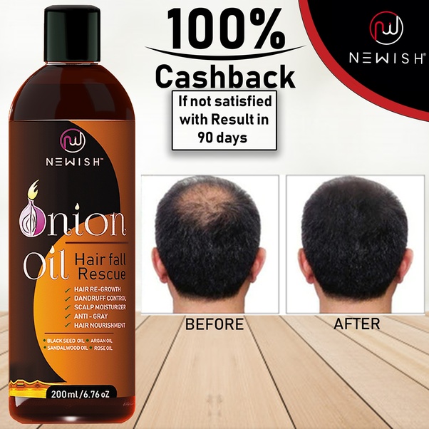 Onions may help hair growth, according to a few small studies for the improvement of alopecia areata. There are two types of onions. Which one is the best for ...