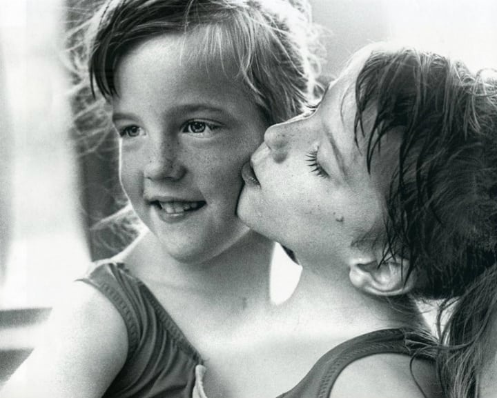 Jika seseorang dilahirkan dengan dua kepala yang berfungsi penuh, yang akan  disingkirkan; atau harus dihilangkan? - Quora