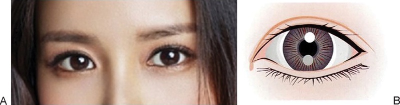 Kamu lebih suka mata sipit atau mata belo? - Quora