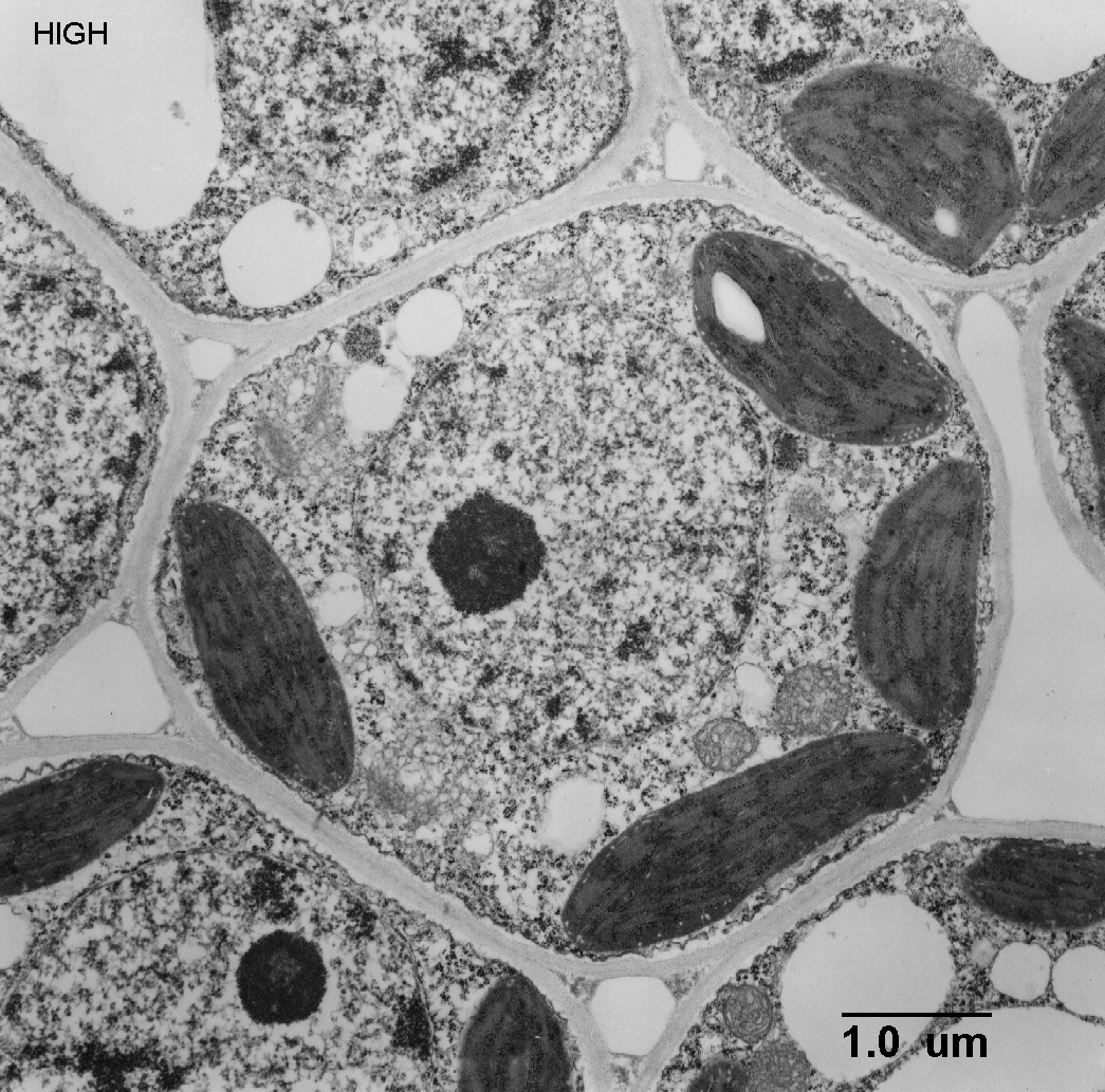 High voltage modern electron … What Is A Diagram Of A Plant And Animal Cell Under An Electron Microscope Quora