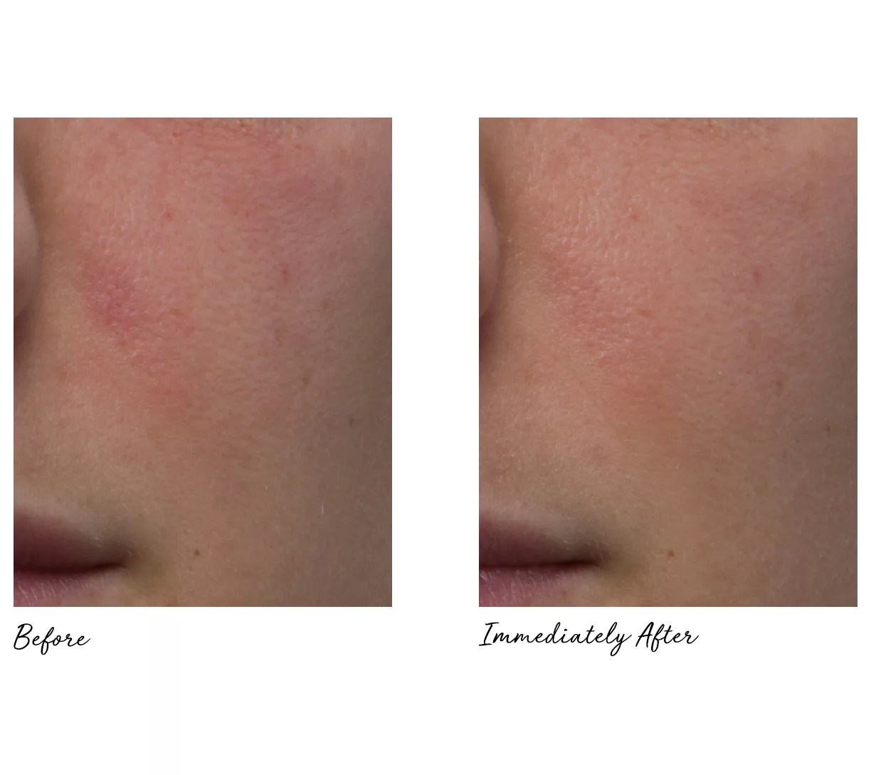 peter thomas roth pumpkin enzyme mask set of 2 51-oz - qvccom on peter thomas roth pumpkin enzyme mask expiration date