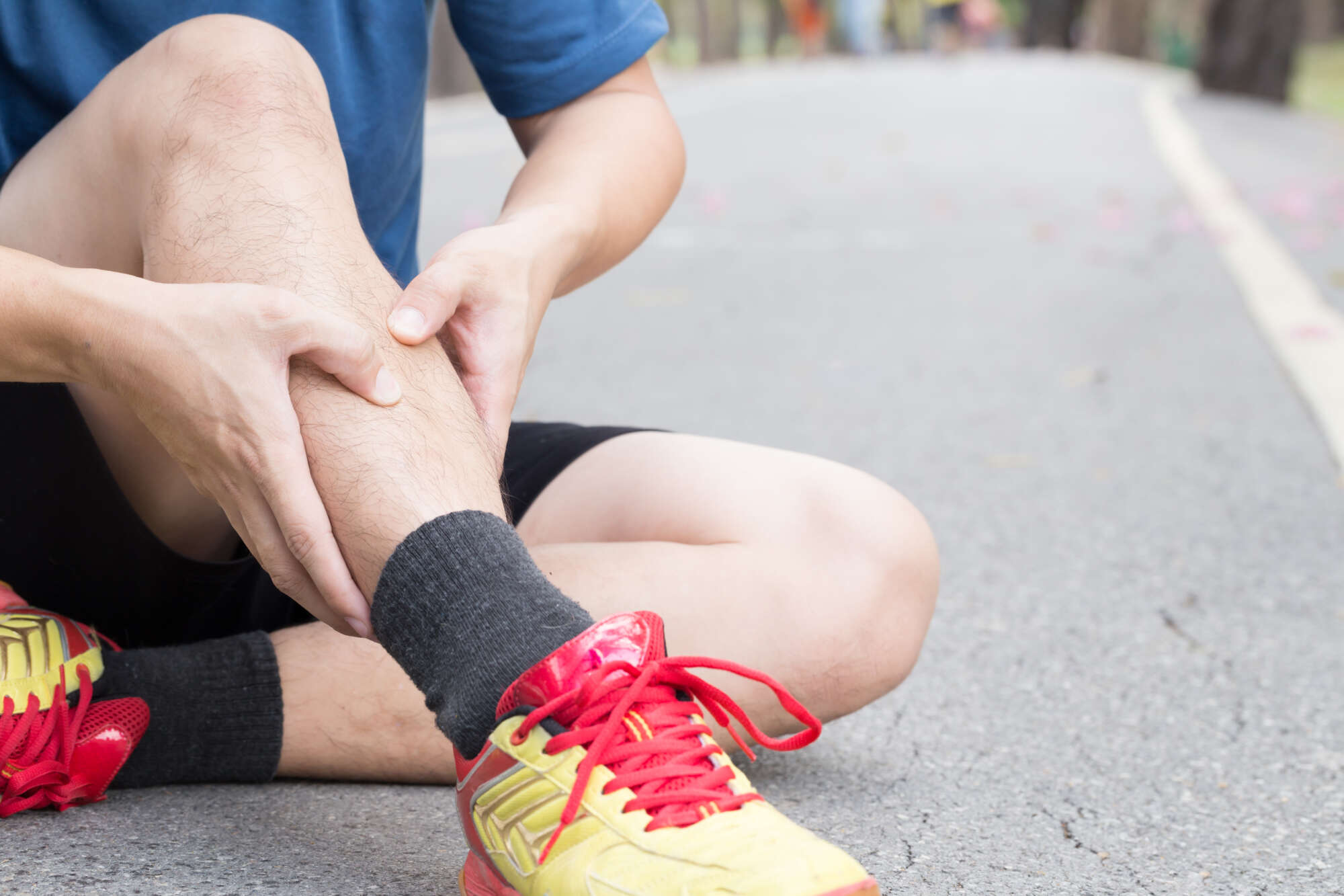 Shin Splints: Complete Managementfeatured image