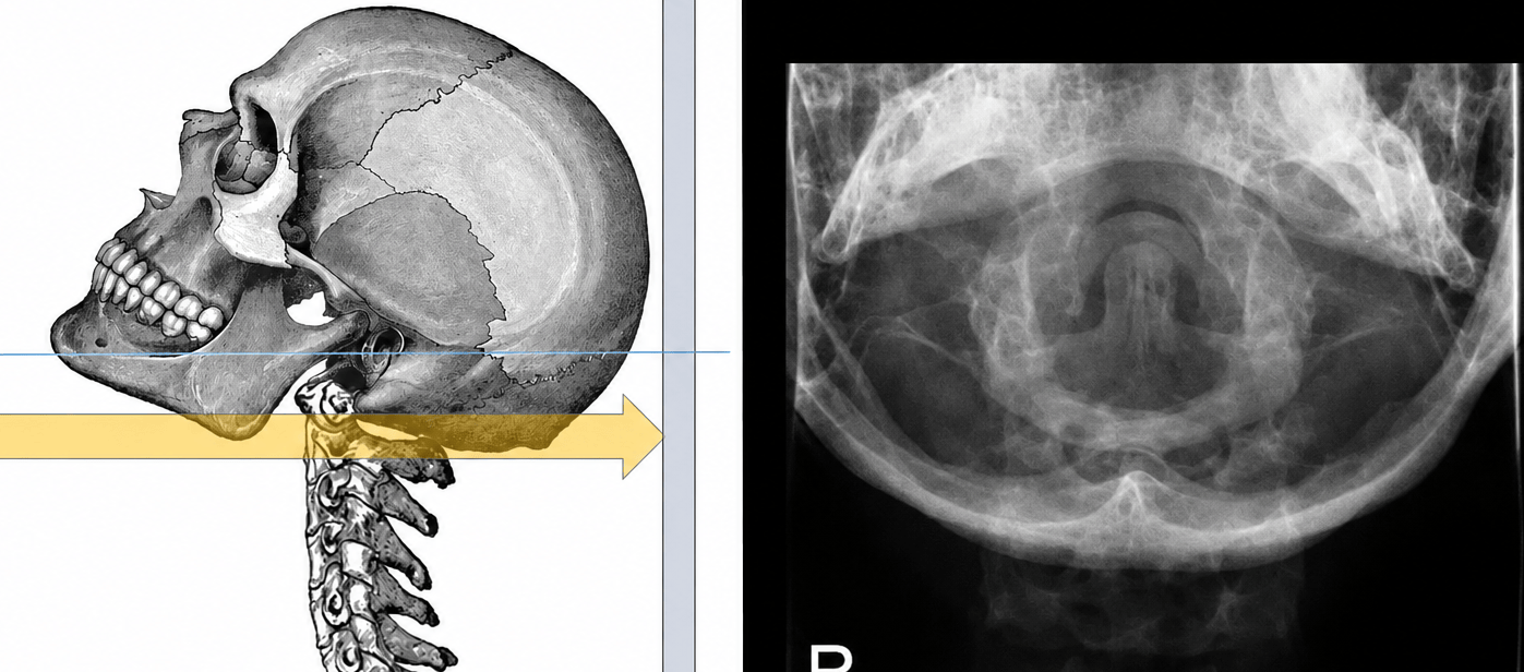 Fuch's View X-ray