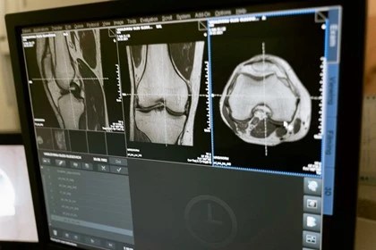 X-ray scans results
