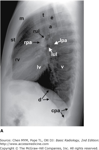 The epidermis is the outermost layer that provides a protective, waterproof seal over the body. Chapter 4 Radiology Of The Chest Radiology Key