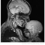 Mother and Child MRI Scan