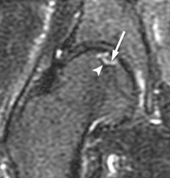 39+ Unique Css Table Inner Border - New feature: Create Custom Invoice templates with Template : If you want to place or draw the borders inside of a rectangular box there is a very simple solution — just use the css outline property instead of border .