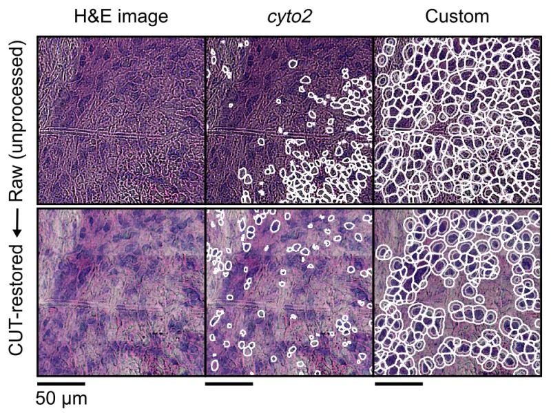 Github Rajewsky Lab Openst Open St Profile And Analyze Tissue - Best Landscape Wallpapers in 4K