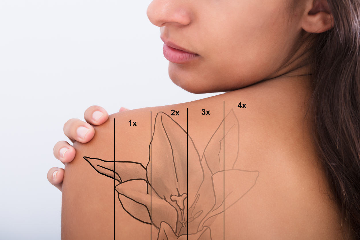 No bulky gym equipment required. Enlighten Laser Tattoo Removal | Rao Dermatology