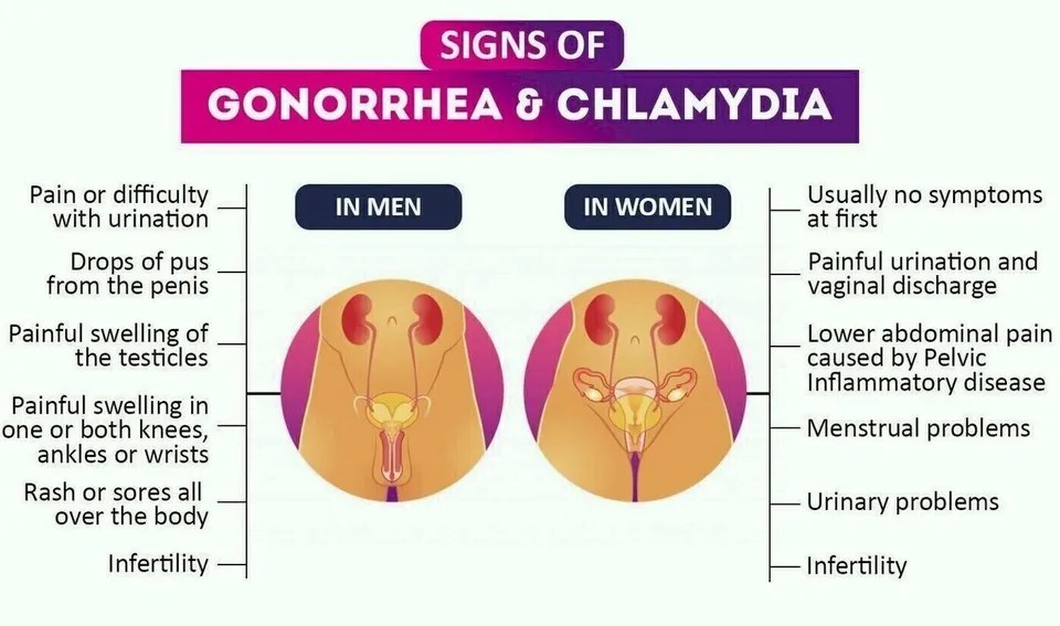 Signs of STI visual Signs of Gonorrhoea & Chlamydia
