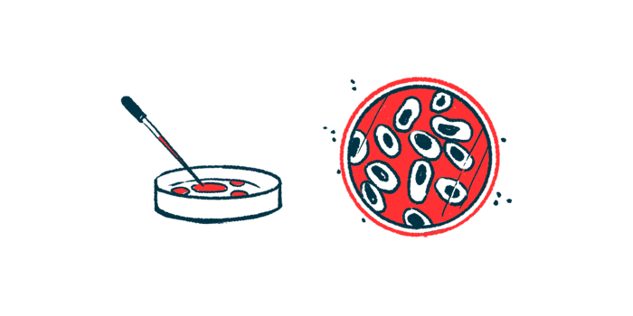 Uncovering Cervical Cancer Secrets: New Cell Model for HPV-Negative Cases (2026)