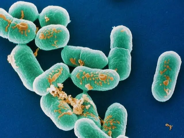 "Deadly Listeria Outbreak: Health Officials Urge Caution with Deli Meats"