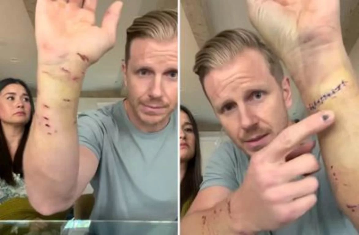  Sean Lowe Attacked by His Dog Twice in 12 Hours: A Harrowing Experience